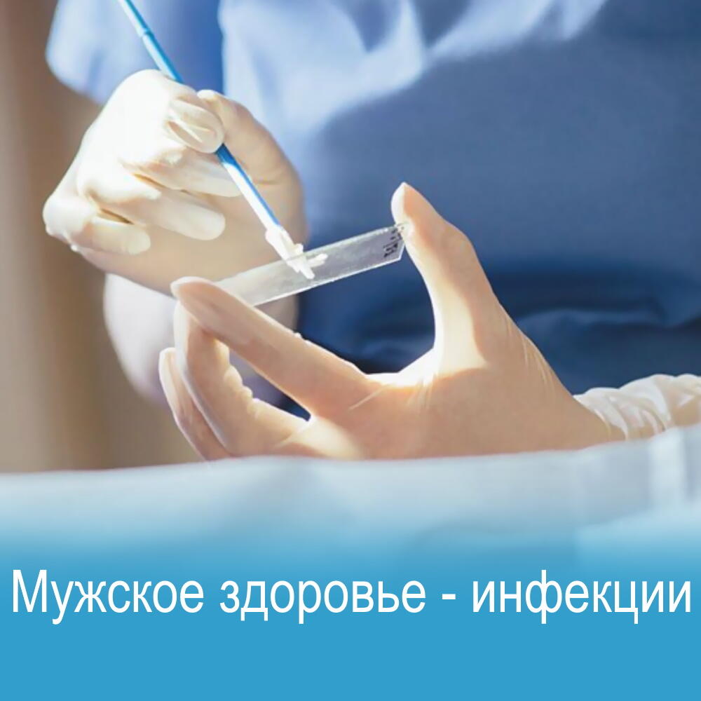 Полное медицинское обследование урологическое обследование мужчин на инфекции в Киеве, Клиника урологии Медиленд